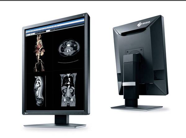 医療用液晶モニター 6205 EIZO RadiForce MX216 21.3インチ DP端子 IPS 回転・縦型表示 LED ディスプレイ