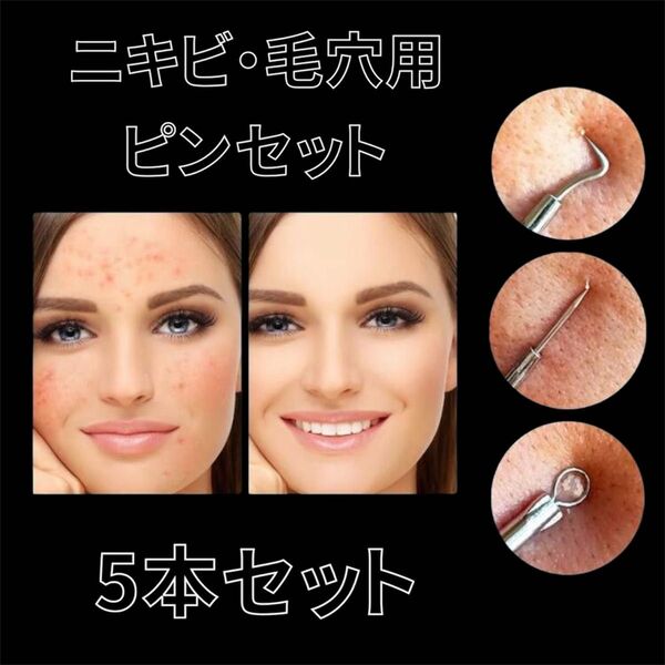 ピンセット 5本セット プッシャー ニキビ 毛穴 角栓 黒ずみ 毛抜き