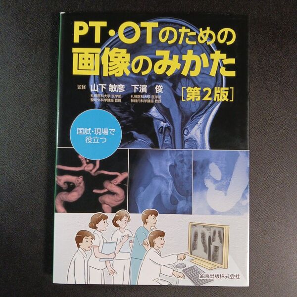 PT・OTのための画像のみかた 国試・現場で役立つ (第2版) 山下敏彦/監修 下濱俊/監修