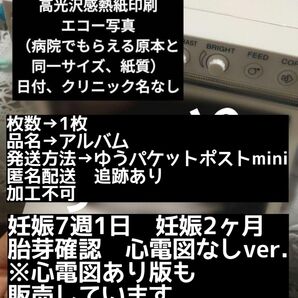 【感熱紙、加工不可】妊娠7週1日 妊娠2ヶ月 妊娠初期エコー写真 胎芽確認
