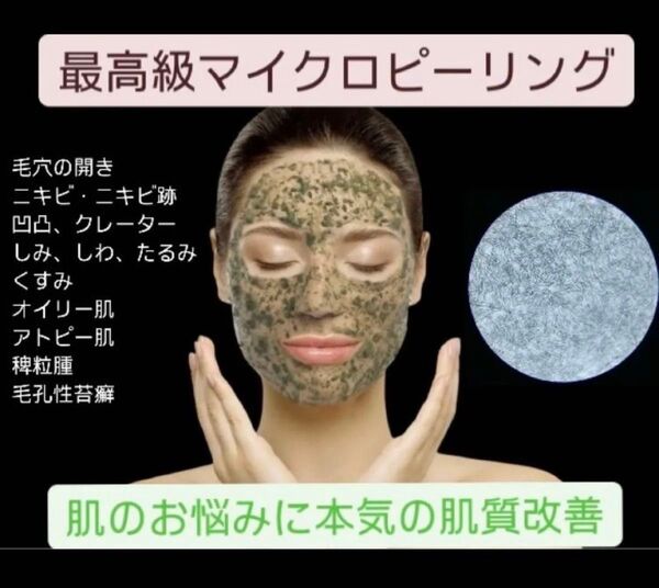 【速攻!感動の肌質改善】最高級マイクロハーブピーリング3回分 剥離ありで、過去最高の自分に出会う!