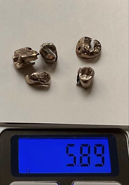 撤去冠 除去冠 5.89g 銀歯 金パラ 金銀パラジウム合金 歯科金属 金 銀 パラジウム 歯科 歯科材料 クラウン インレー