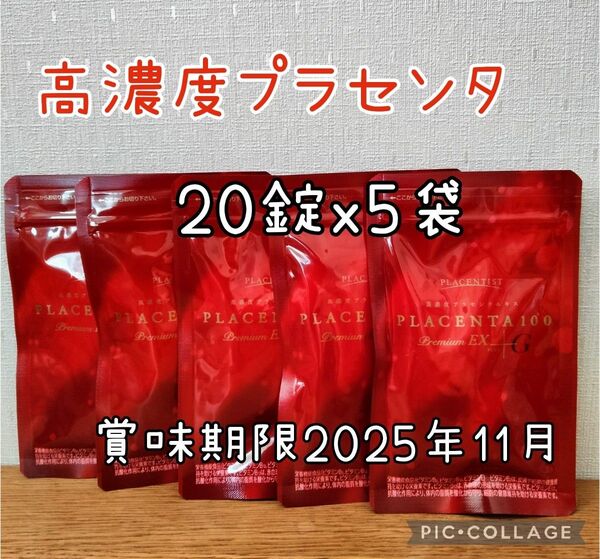 高濃度プラセンタサプリメント プラセンタ100 プレミアムEX 20粒x5包