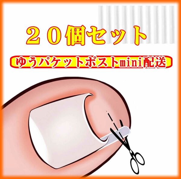 巻き爪保護チューブ 陥入爪や巻き爪の保護プレート 20本 巻き爪矯正