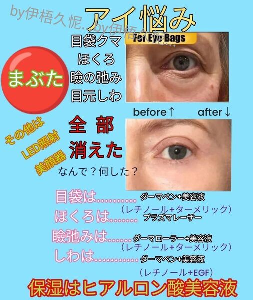 レチノール30本&ダーマローラーヒアルロン酸llほうれい線マイクロニードル美容液ダーマペンしわダーマスタンプ水光注射まぶた弛み