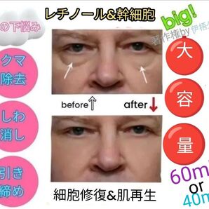 40ml or 60mlレチノール&幹細胞ヒアルロン酸美容液llほうれい線マイクロニードルダーマペンしわダーマスタンプ水光注射