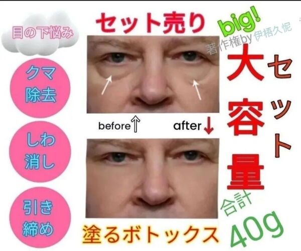 計40g塗るボトックスアイクリーム美容レチノール保湿ヒアルロン酸ターメリック ビタミンC コラーゲン lほうれい線マイクロニードル