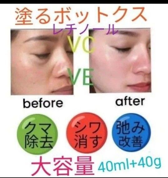 大容量塗るボトックス美容幹細胞&レチノール保湿ヒアルロン酸ターメリック ビタミンC コラーゲン lほうれい線マイクロニードル