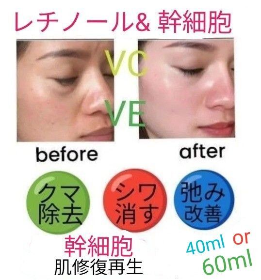 40ml or 60mlレチノール&幹細胞ヒアルロン酸美容液llほうれい線マイクロニードルダーマペンしわダーマスタンプ水光注射