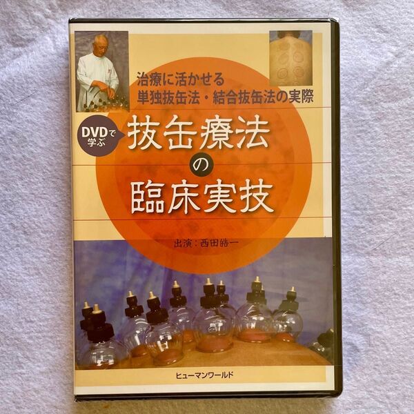 抜缶療法の臨床実技 DVD 【治療院先生のスキルアップに】