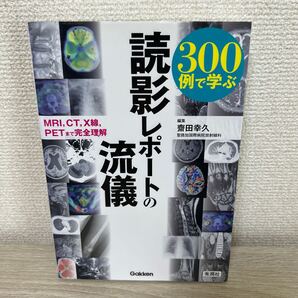 300例で学ぶ 読影レポートの流儀 MRI,CT,X線,PETまで完全理解 齋田幸久/編集