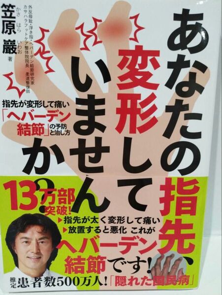 あなたの指先、変形していませんか?─指先が変形して痛い「ヘバーデン結節」の予防と治し方 笠原 巖 あなたの指先 変形していませんか