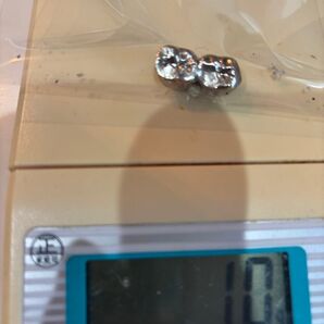 撤去冠 銀歯