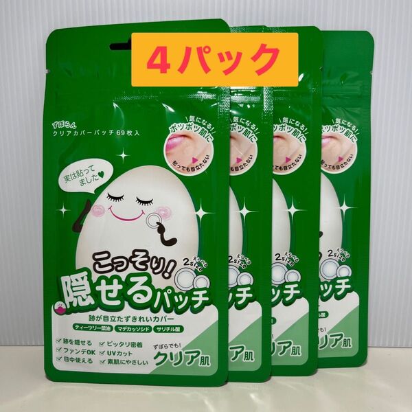 ずぼらん クリアカバーパッチ 69枚入【4パック入】