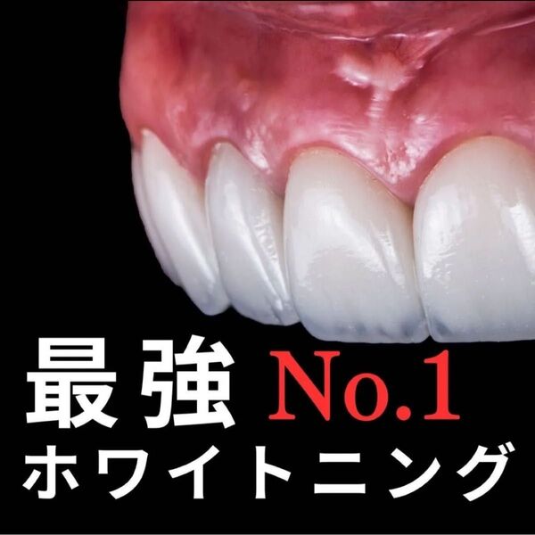 モデル絶賛 究極のホワイトニング 歯磨き粉 セラミックを超えた白さ ジェル シート ライト 不用 圧倒的な白さへ GWに白い歯を