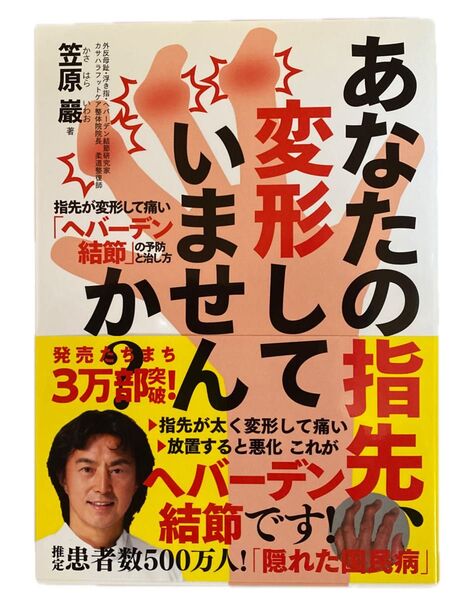 あなたの指先、変形していませんか? 指先が変形して痛い「ヘバーデン結節」の予防と治し方 笠原巖/著