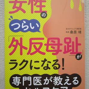 女性のつらい外反母趾がラクになる 専門医が教えるセルフケア 桑原靖 脚 足 指 足指 がいはんぼし 病気 治療 リハビリ 医療 痛み 改善 本