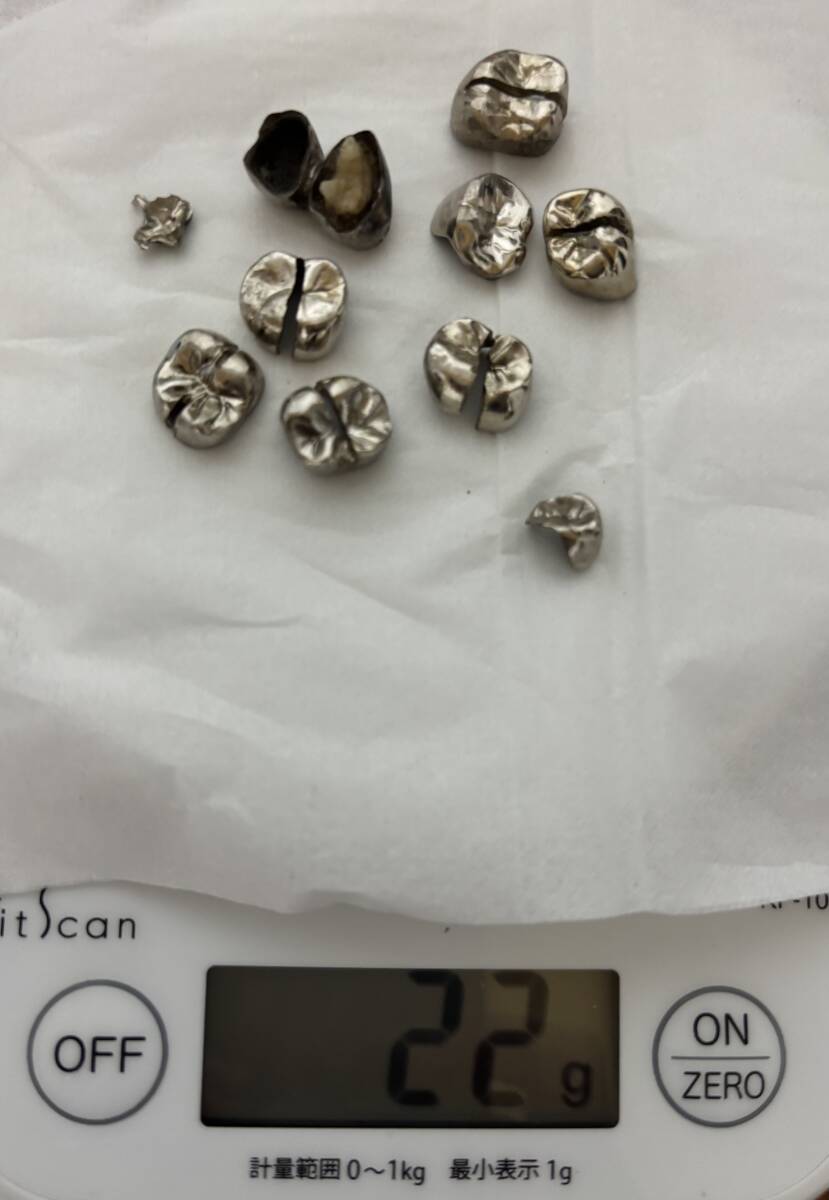 銀歯、除去冠 Yahoo!オークション -「撤去冠」の落札相場・落札価格