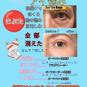 ヒアルロン酸美容液30mlx2保湿llほうれい線マイクロニードル美容液ダーマペンしわダーマスタンプ水光注射ダーマローラー