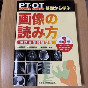 PT・OT基礎から学ぶ画像の読み方 国試画像問題攻略 (第3版) 中島雅美/編著 中島喜代彦/編著 大村優慈/編著