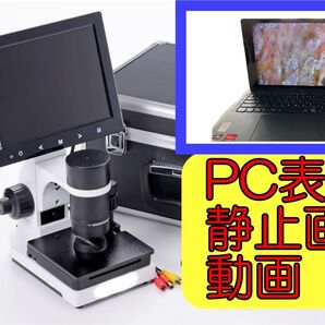 新品 PCで表示OK 高品質 血流スコープ 600倍 8インチ 電源ON/OFF