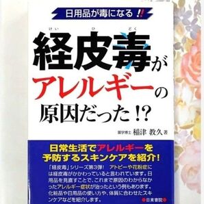 経皮毒がアレルギーの原因だった!? 日用品が毒になる 稲津教久 アレルギー 健康 医療 経皮毒 アトピー スキンケア 花粉症 本