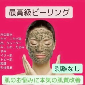 【緊急美肌チャージ】最高級ハーブピーリング3回分 剥離なし 痛みなし ダウンタイムなし