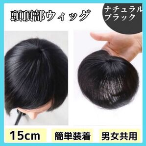 【ナチュラルブラック】つむじ 頭頂部 ウィッグ ヘアピース 部分かつら 薄毛