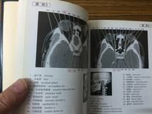 即決　病院払下げ本　新版 ポケットCT解剖アトラス　河野 敦_画像4