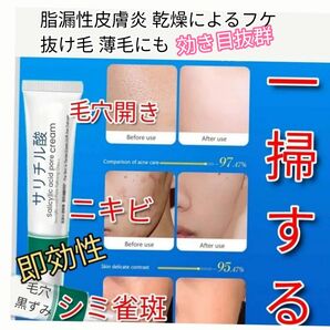 新品 1個サリチル酸クリーム20g 重度ニキビも即刻性 高濃度有効成分角質除去毛穴詰まりイチゴ鼻フケ薄毛抜け毛肌荒れ黒ずみ小じわに
