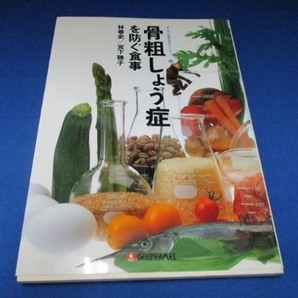 骨粗しょう症を防ぐ食事 (すこやか食生活シリーズ) 単行本