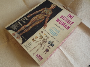プラモデル『RENWAL／THE VISIBLE WOMAN』未組立品 アメリカ製 女性人体模型 当時物超レア品
