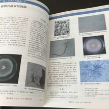 あ53 食中毒 臨床検査 2009年6月号 医学書院 病気 医者 免疫 医学 治療 ノロウィルス 細菌性 ウイルス 毒物 ヒト細胞 ボツリヌス 食品_画像8