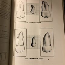 ホイーラー 歯の解剖・生理・咬合学 第6版_画像5