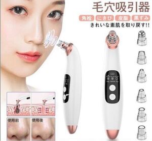 毛穴吸引器 美顔器毛穴クリーンニキビ吸引 黒ずみ吸出 美肌効果 フェイスケア 毛穴ケア