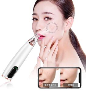 毛穴吸引器 カメラWiFiビジュアル付き毛穴クリーナ LEDディスプレイ搭載毛穴ケア美顔器 3段階吸引力 3種類ヘッド