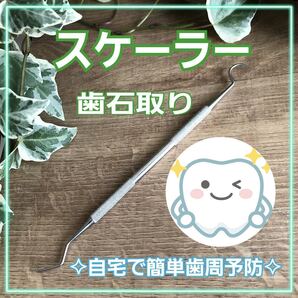 歯石取り スケーラー☆歯石除去☆オーラルケア \デンタルケア/ ヤニ取り
