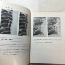 zaa-254♪胸部X線読影テキスト 単行本 1980/2/1 田坂晧 (著)　文光堂_画像5