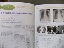 ★THE LUNG perspectives 24ー3 超高齢化時代の呼吸器診療_画像2