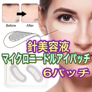 マイクロニードル アイパッチ!! 6パッチ!! 3回分!!ヒアルロン酸 コラーゲン 針状美容液!!アイケア美容液