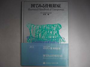 図でみる骨粗鬆症 非売品