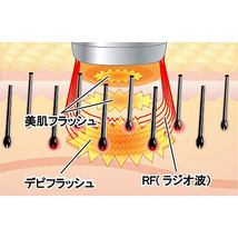 脱毛器 ハイパワーワイドフラッシュエステ キセノンフラッシュ ムダ毛ケア_画像4