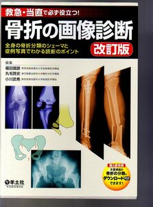 救急・当直で必ず役立つ！ 骨折の画像診断 改訂版 全身の骨折分類のシェーマと症例写真でわかる読影のポイント 羊土社 (整形外科 救急医