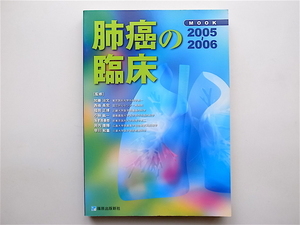 1902　MOOK 肺癌の臨床 2005-2006