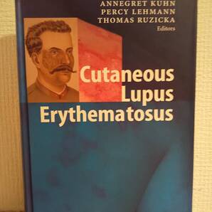 〈洋書〉皮膚エリテマトーデス Cutaneous Lupus Erythematosus