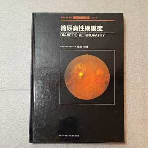 zaa-320♪糖尿病性網膜症 (カラーアトラス網脈絡膜疾患シリーズ) 福田 雅俊 (著)　ライフサイエンス出版　単行本 1984/12/20