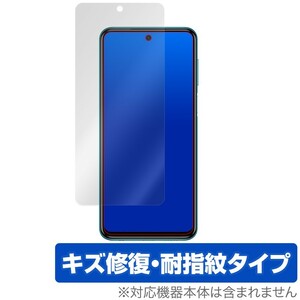 Redmi Note9S 保護 フィルム OverLay Magic for Redmi Note 9S 液晶保護 キズ修復 耐指紋 防指紋 コーティング シャオミ レドミノート9s