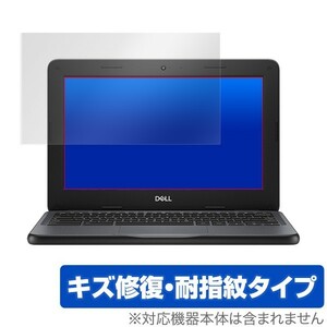 デル クロームブック11 3100 用 保護 フィルム OverLay Magic for DELL Chromebook 11 3100 Education キズ修復 防指紋 コーティング