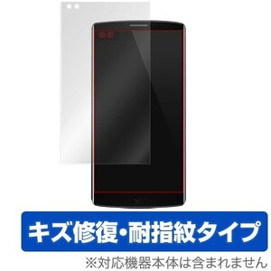 OverLay Magic for LG V10 液晶 保護 フィルム シート シール キズ修復 耐指紋 防指紋 コーティング