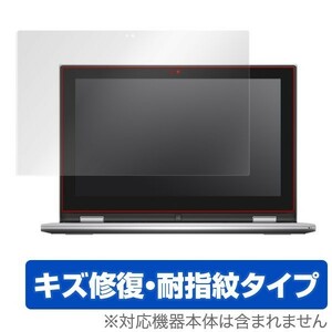 OverLay Magic for DELL Inspiron 11 3000シリーズ 2 in 1 (2015/2014年モデル) 液晶 保護 フィルム シート